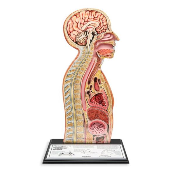 Tube Feeding Nasogastric Ea